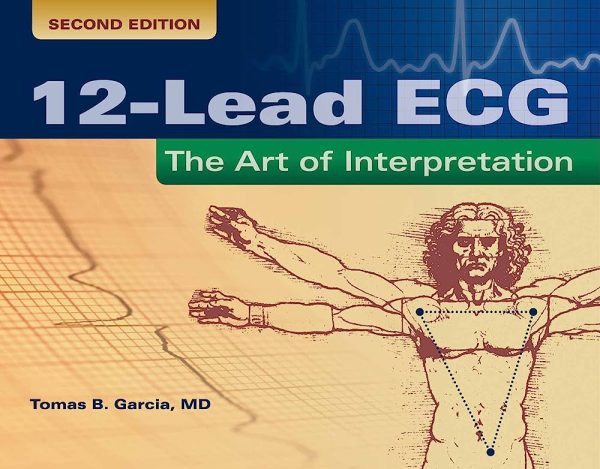 12-Lead ECG; The Art Of Interpretation (2nd Edition)