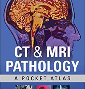 CT and MRI Pathology: A Pocket Atlas (3rd Edition)