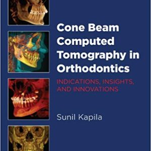 Cone Beam Computed Tomography in Orthodontics: Indications; Insights; and Innovations