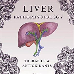 Liver Pathophysiology: Therapies and Antioxidants