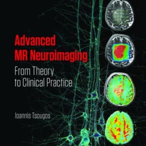 Advanced MR Neuroimaging: From Theory to Clinical Practice (PDF) by